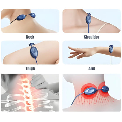 Dispositif de stimulation électrique pour le soulagement de la douleur appliqué à différentes parties du corps.