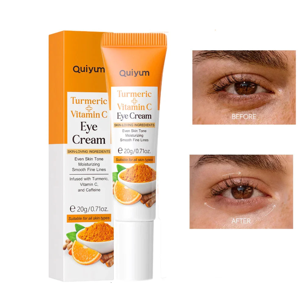 Crème pour les yeux au curcuma et à la vitamine C avec des photos comparatives avant/après montrant les zones sous les yeux.