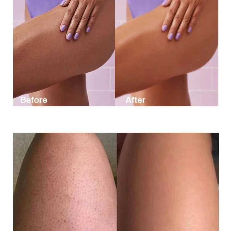 Photos comparatives avant et après montrant les changements de texture de la peau sur les jambes.