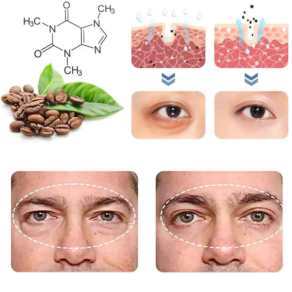 Illustration chimique et biologique montrant la structure moléculaire de la caféine et ses effets sur le tissu cutané et l’apparence des paupières.