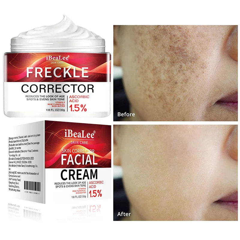 Crème correctrice pour taches de rousseur avec photos comparatives de la peau avant et après.