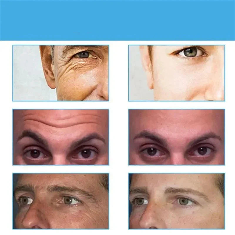 Comparaison des yeux et des zones cutanées environnantes avant et après le traitement ou la modification.