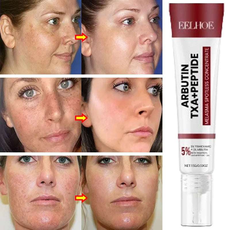 Le produit de soin Arbutin TAA-peptide est présenté avec des photos de comparaison avant et après le traitement de la peau.