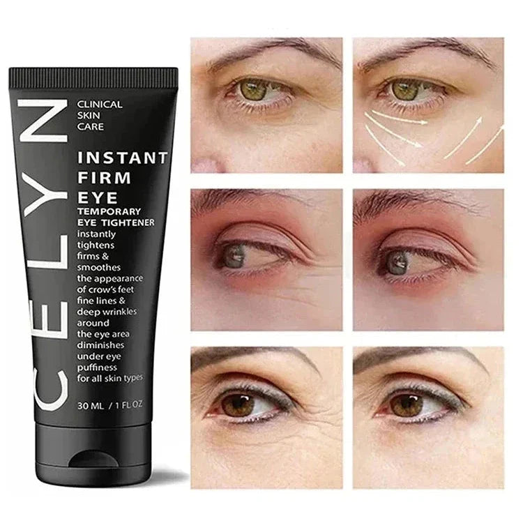 Tube noir de la crème Celyn Instant Firm Eye présenté avec des photos avant/après de l’application sur le contour des yeux.