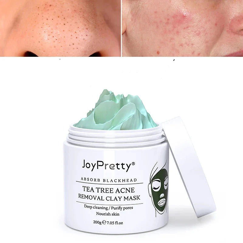 Masque à l’argile de couleur menthe dans un pot blanc étiqueté ’JoyPretty Tea Tree Acne Removal Clay Mask’ (masque à l’argile contre l’acné).