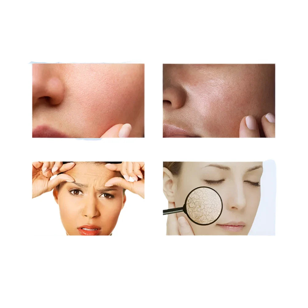 Collage de gros plans de la peau du visage montrant différentes techniques d’examen dermatologique.