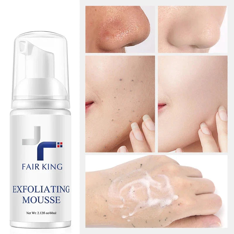 Flacon blanc de la mousse exfoliante Fair King avec texte et logo bleus.