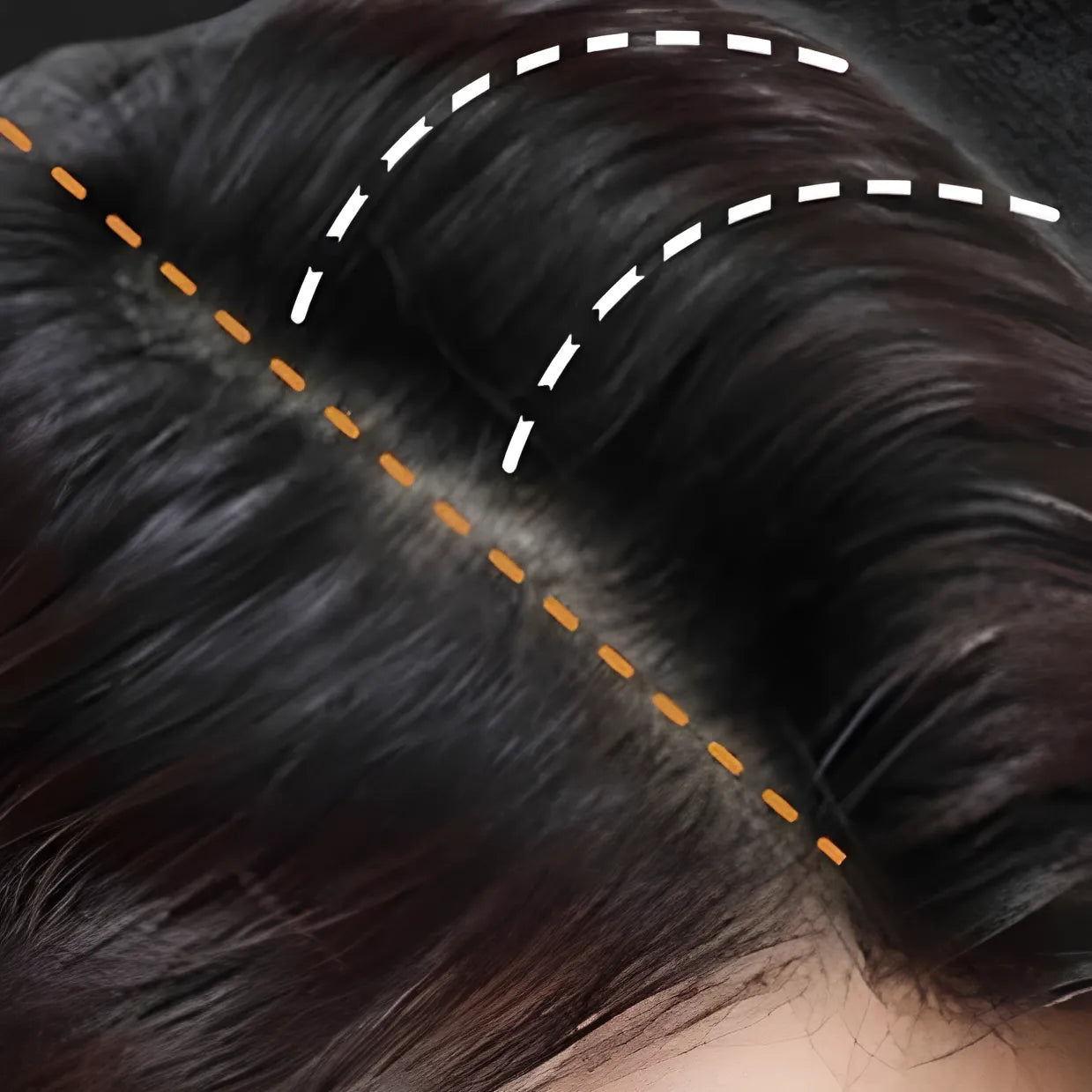 Cheveux foncés avec des lignes de séparation indiquées par des pointillés blancs et orange.