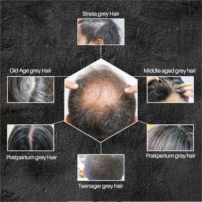 Diagramme montrant les différents types de cheveux gris et leurs causes, disposés de manière hexagonale.