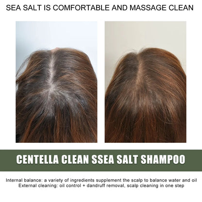 Photos avant et après le traitement des cheveux montrant les effets du shampooing Centella Clean Sea Salt sur le cuir chevelu.