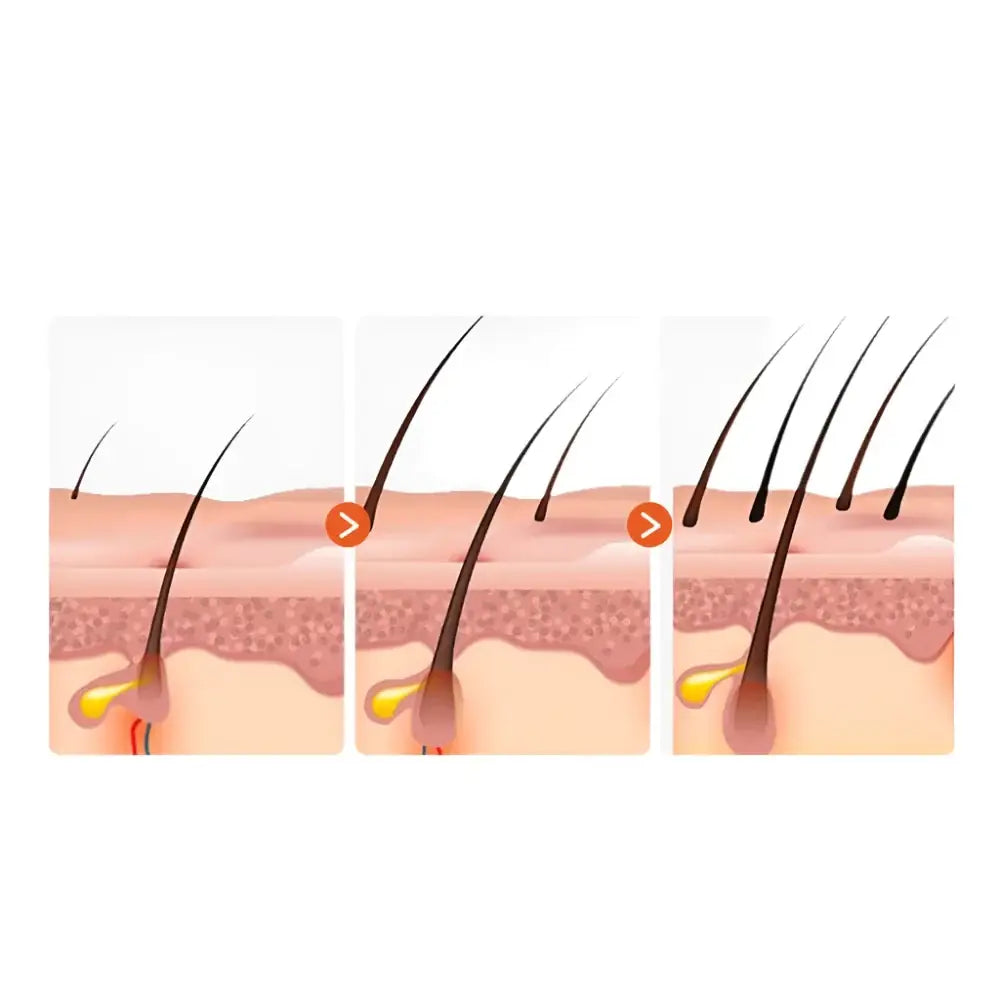 Illustration médicale montrant les étapes de la croissance des cheveux et l’anatomie du follicule en coupe transversale.